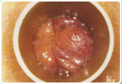 I-II fok� bels�arany�r